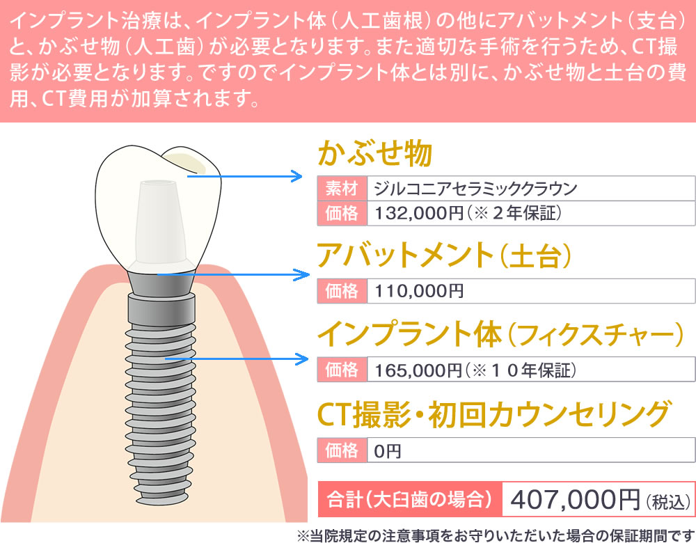 インプラント治療費例